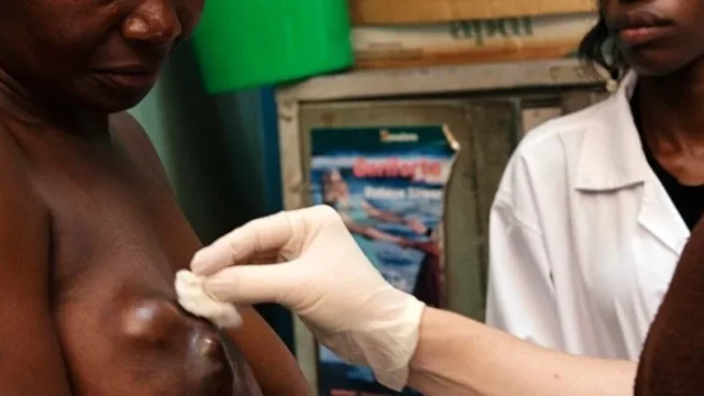 Cancer du sein : comment le reconnaître et le soigner, ce qu’il faut savoir ?