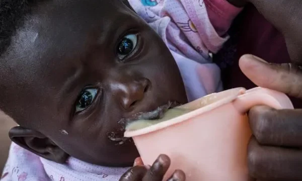 Malnutrition en Guinée : plus de 30% des enfants sont touchés